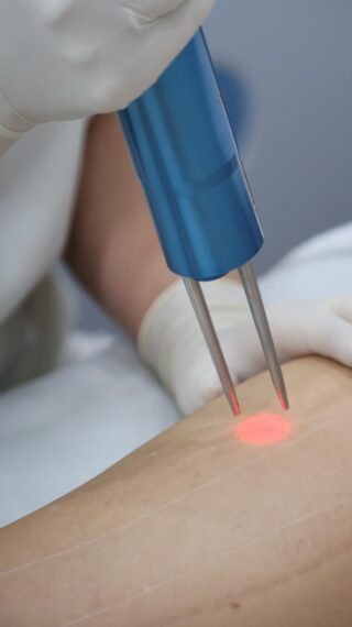 Laser Hair Removal. Laser Hair Removal.